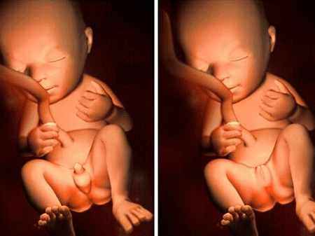 四维彩超主要是检查什么呢