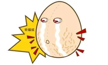 怀孕长妊娠纹怎么办